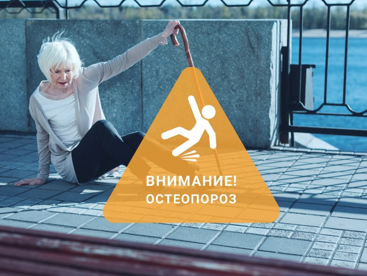 Неделя профилактики остеопороза. Неделя профилактики остеопороза.